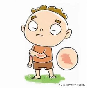 身上长了很多的红疙瘩特别痒,身上长了很多的红疙瘩还掉皮