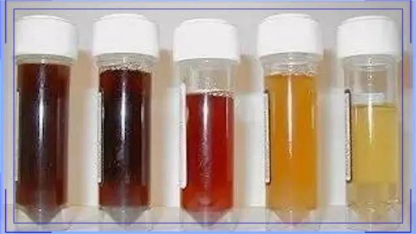 小孩子得了肾炎的症状,孩子肾炎的三大早期症状