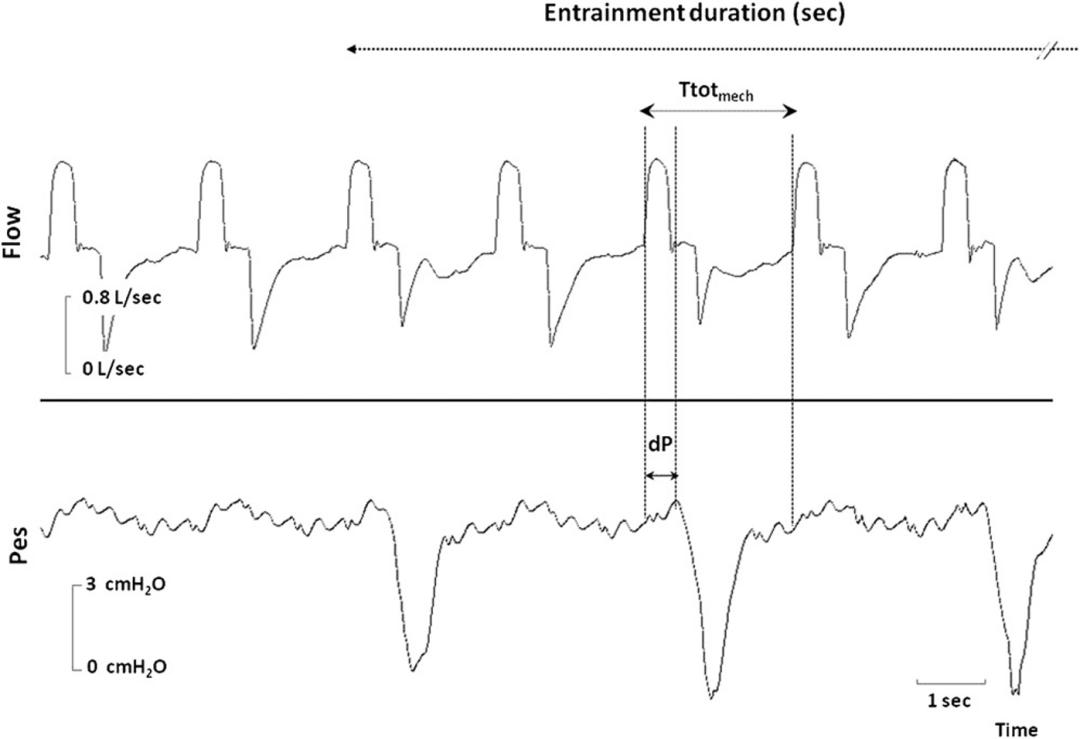 罗红教授,机械通气波形分析和临床应用