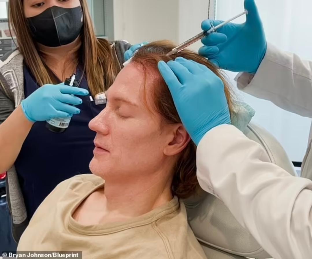 硅谷富豪换血长生不老,长生不老的富豪用自己儿子换血