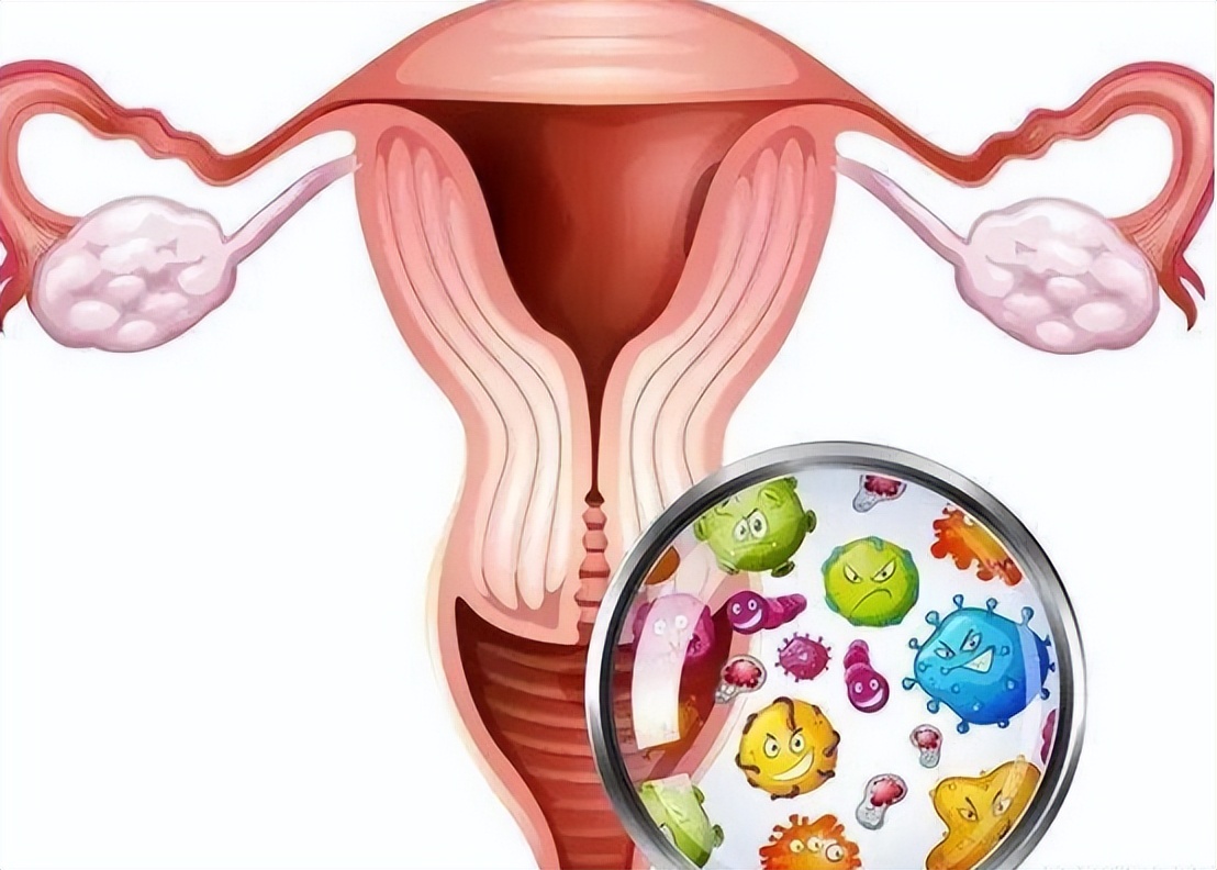 子宫性不孕要如何诊断,查不孕不育查出宫颈病变