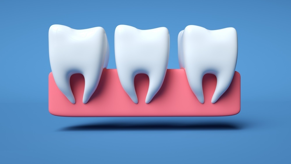 牙龈肿痛吃安博诺降压药可以吗,长期吃降压药和牙龈肿痛有关系吗