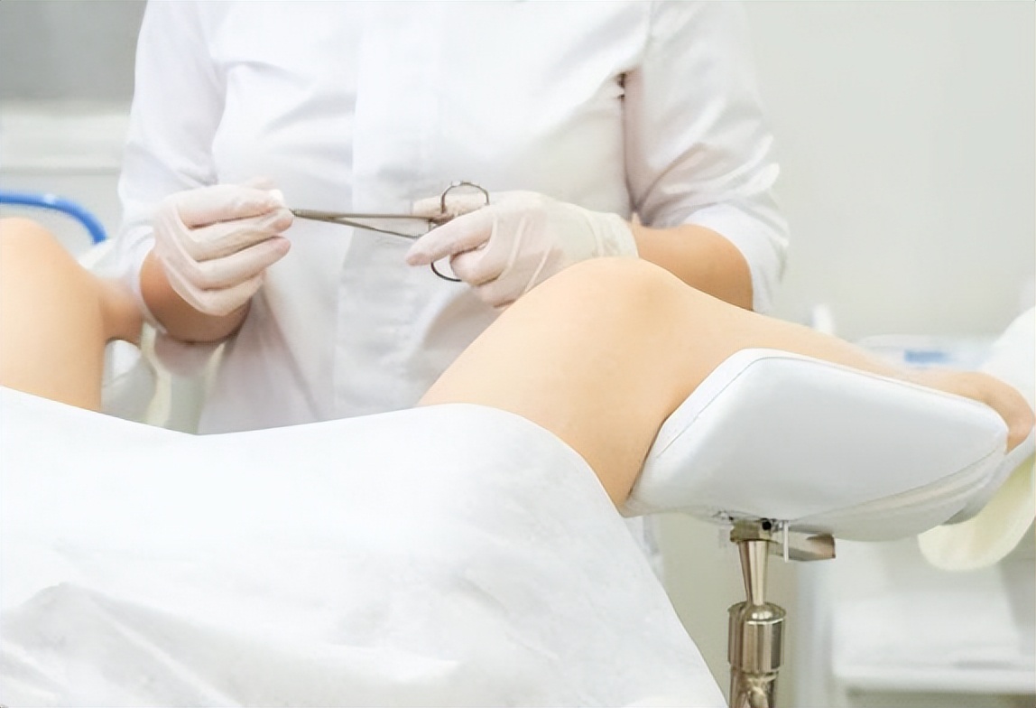 “裤子脱了腿张开”，医院里让人脸红的妇科检查，你做过几个？