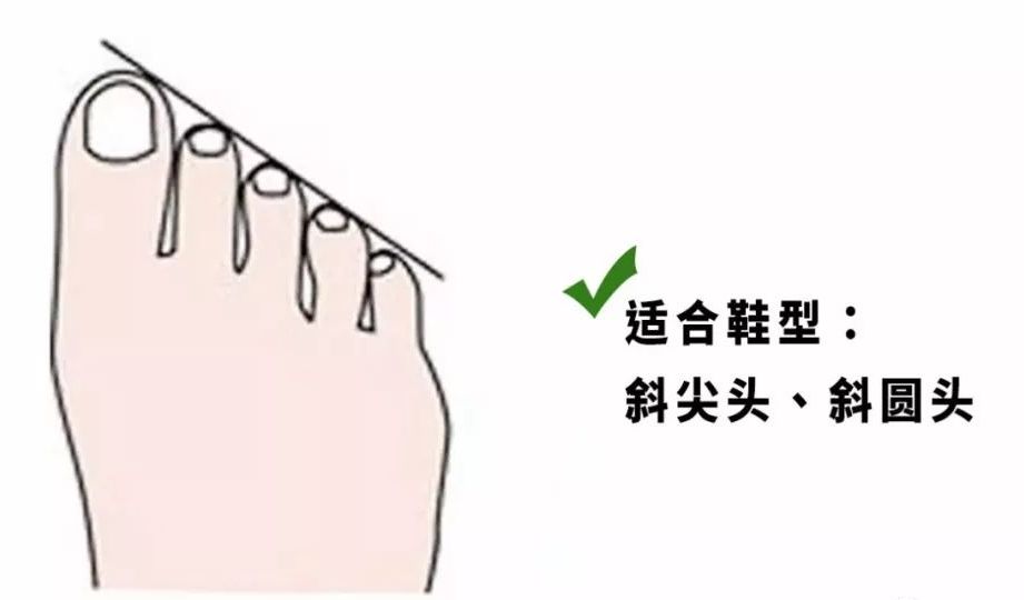 鞋子磨脚怎么办教你如何轻松解决,鞋子太紧磨脚