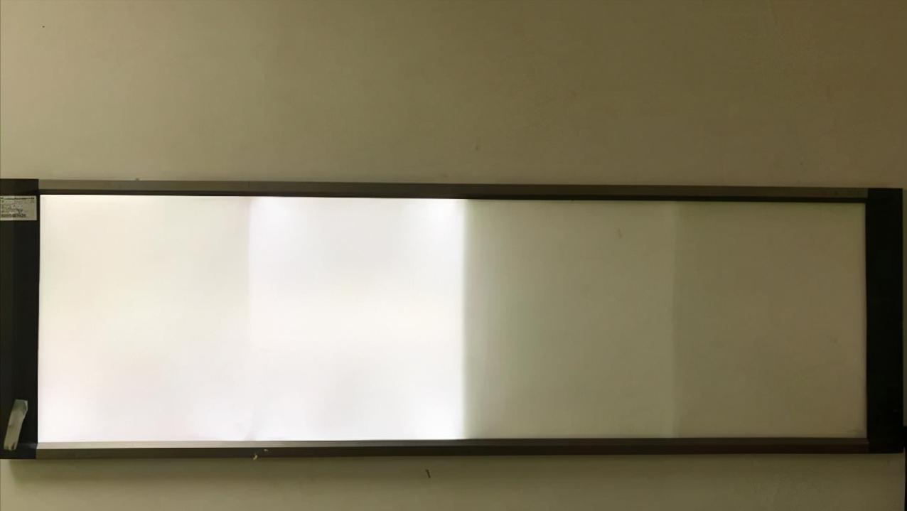 在家如何拍ct片子,在家可以拍ct