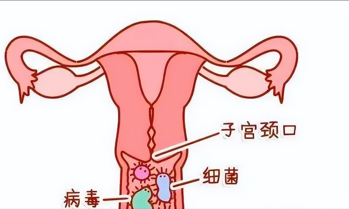 低危hpv11阳性是什么意思,hpv11阳性是出轨感染的吗