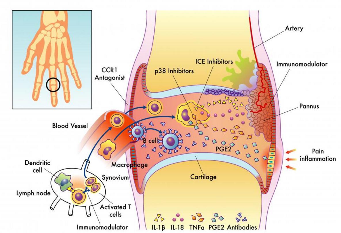 大姨妈拉肚子用什么药,大姨妈拉肚子中医