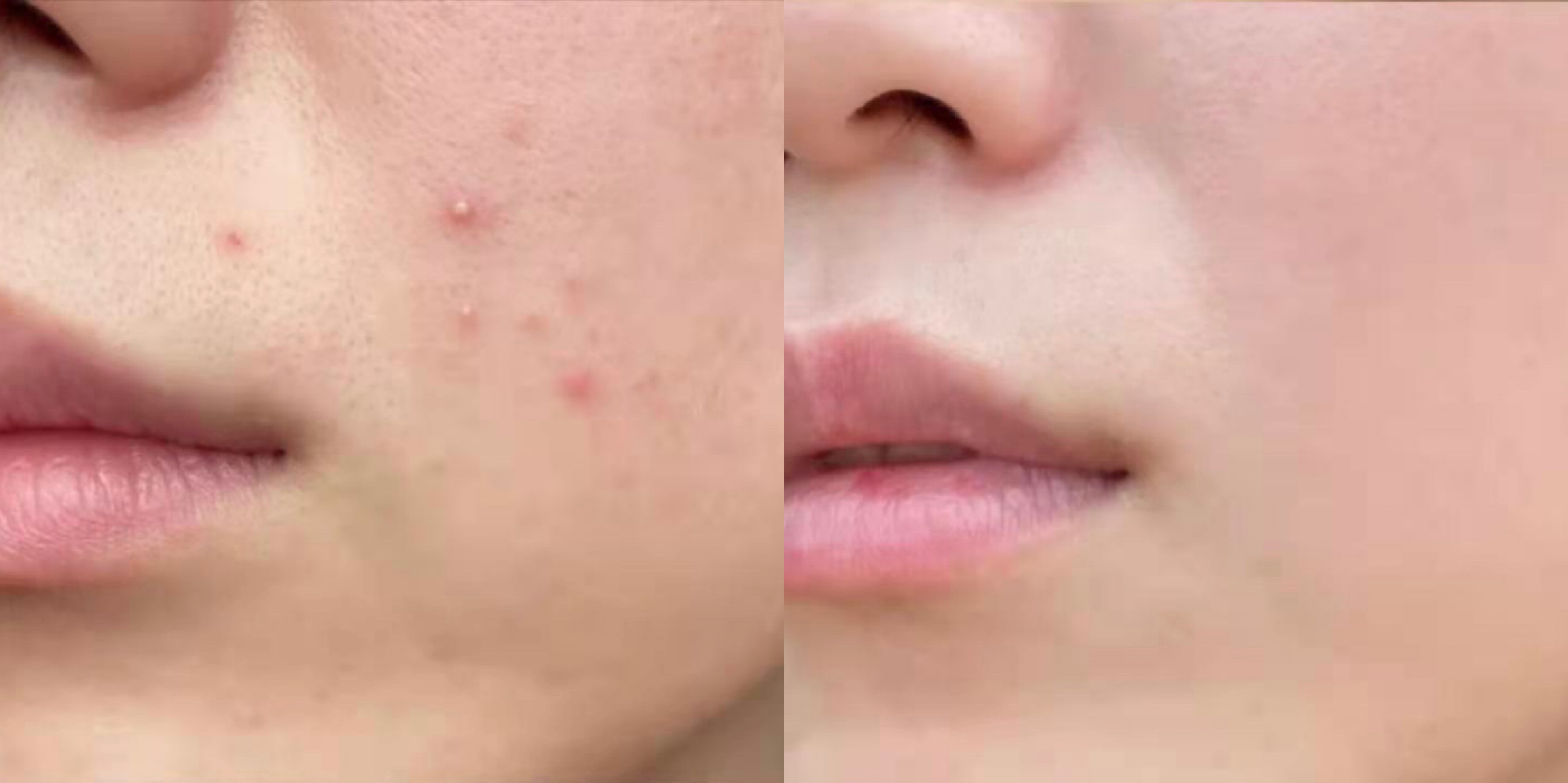 寻荟记芦荟胶,寻荟记芦荟胶老爸评测