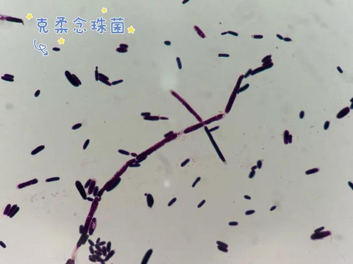 经常穿紧身内裤的坏处,经常穿紧身裤子对身体有影响吗