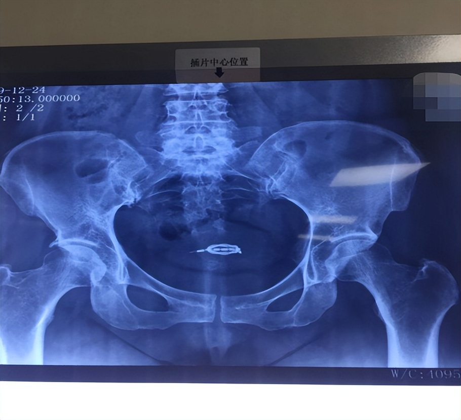 我的体内有一个地球,我的体内有个地球