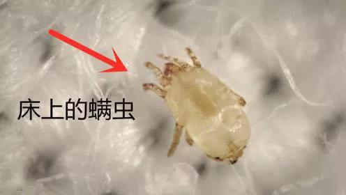 有哪些除螨的办法可靠,除螨怎么能看出有没有效果