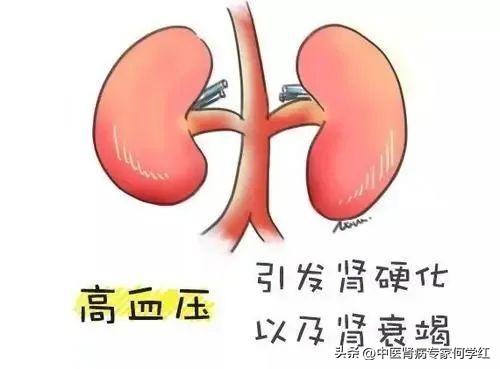 尿蛋白总降不下来原因到底在哪,尿蛋白迟迟降不下来是什么原因