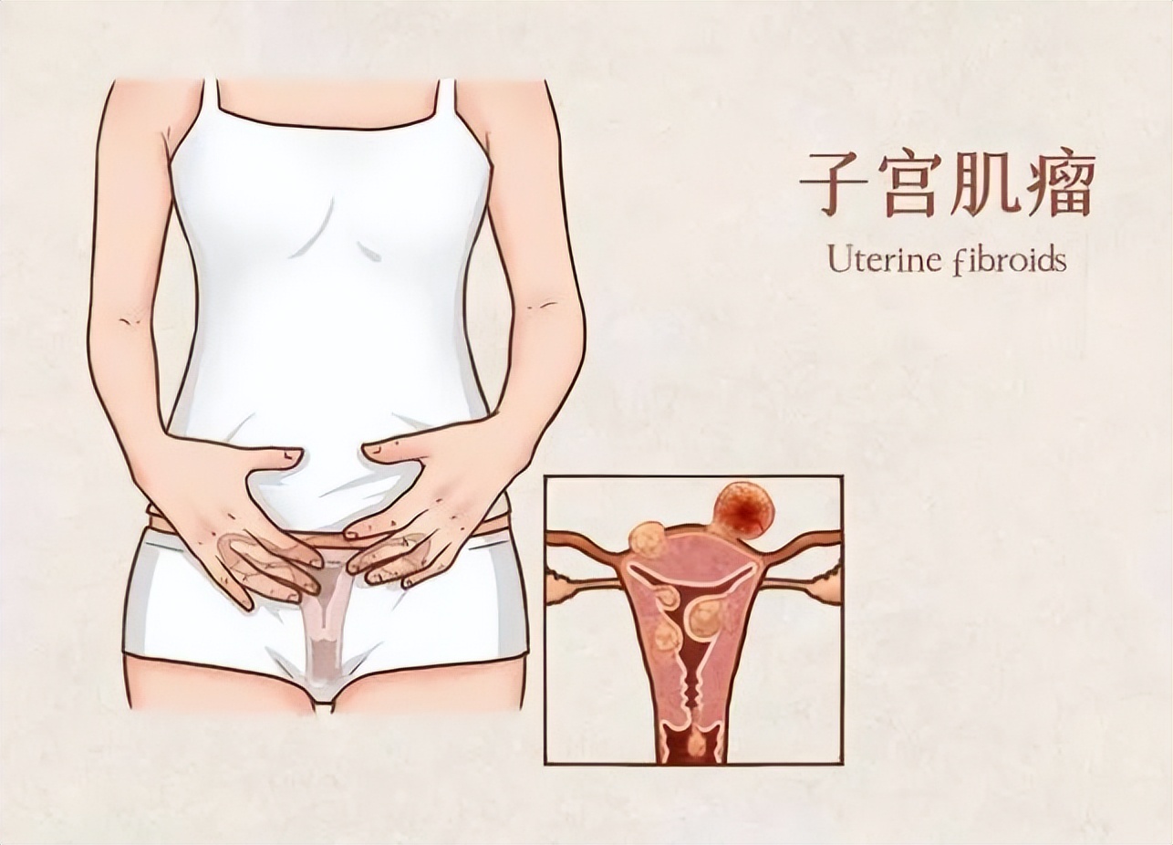 女人摘掉子宫后，和正常的女性有何不同呢？医生说出实话