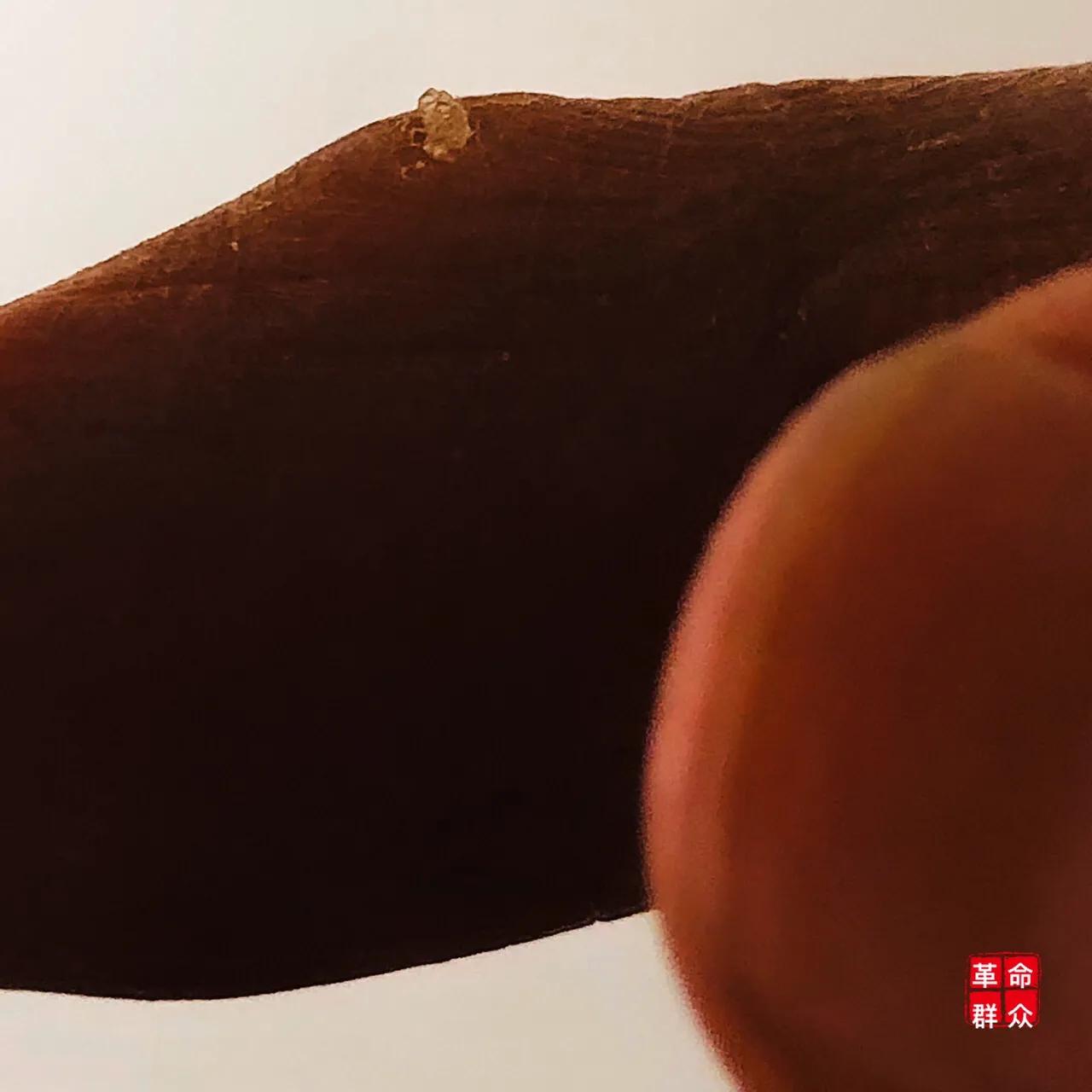 学生握笔防老茧,握笔多了老茧