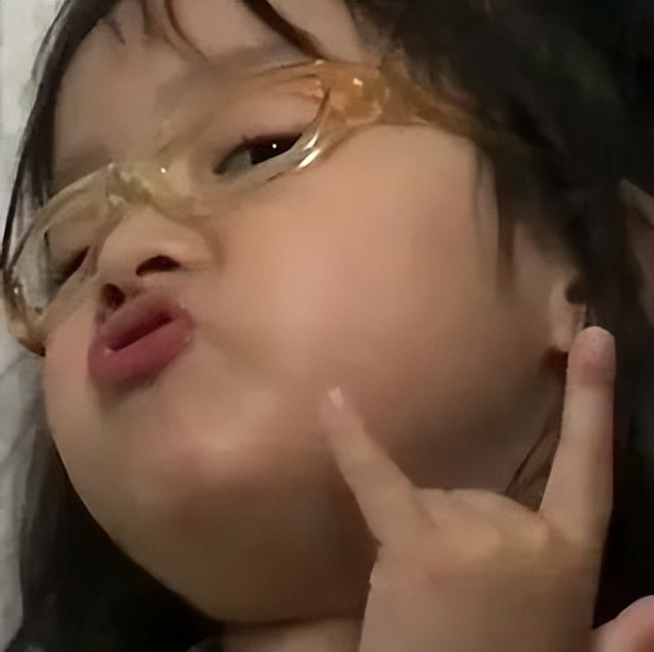 指甲抓头皮有白色的泥,头皮总能抠下来白泥