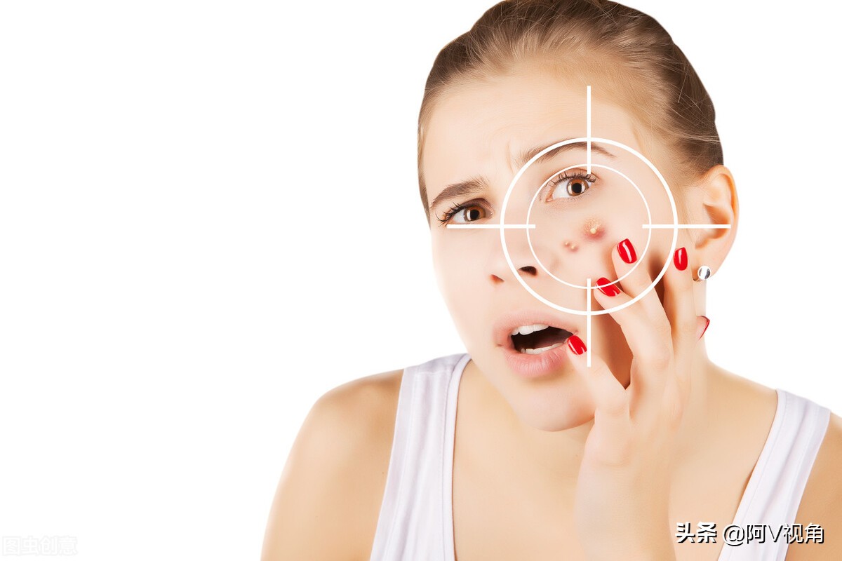 脸上长痘痘了怎么消除最快方法,脸上长痘痘怎么办快速解决小妙招