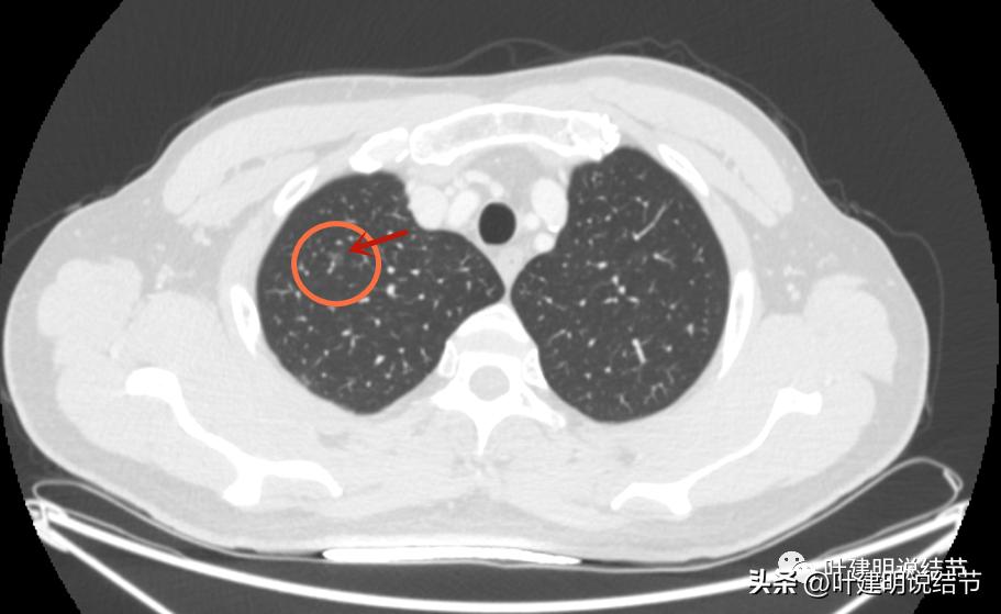 医生为了预防医患矛盾过度诊疗,医院过度医疗手术
