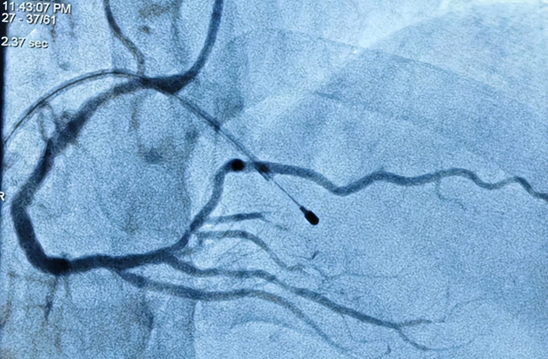 如何成为心内科医生,心内科医生养成记