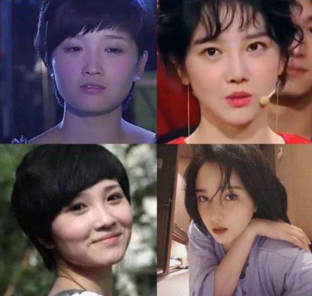 盘点整容失败惨不忍睹的30位女星,那些整容整失败的女明星