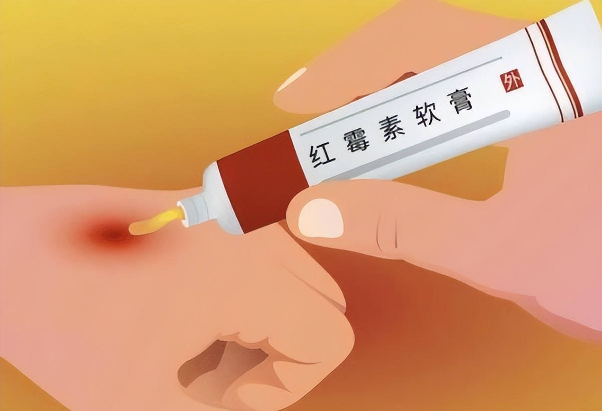 2块钱的红霉素软膏有淡斑效果吗,红霉素软膏的淡斑方法真实测评