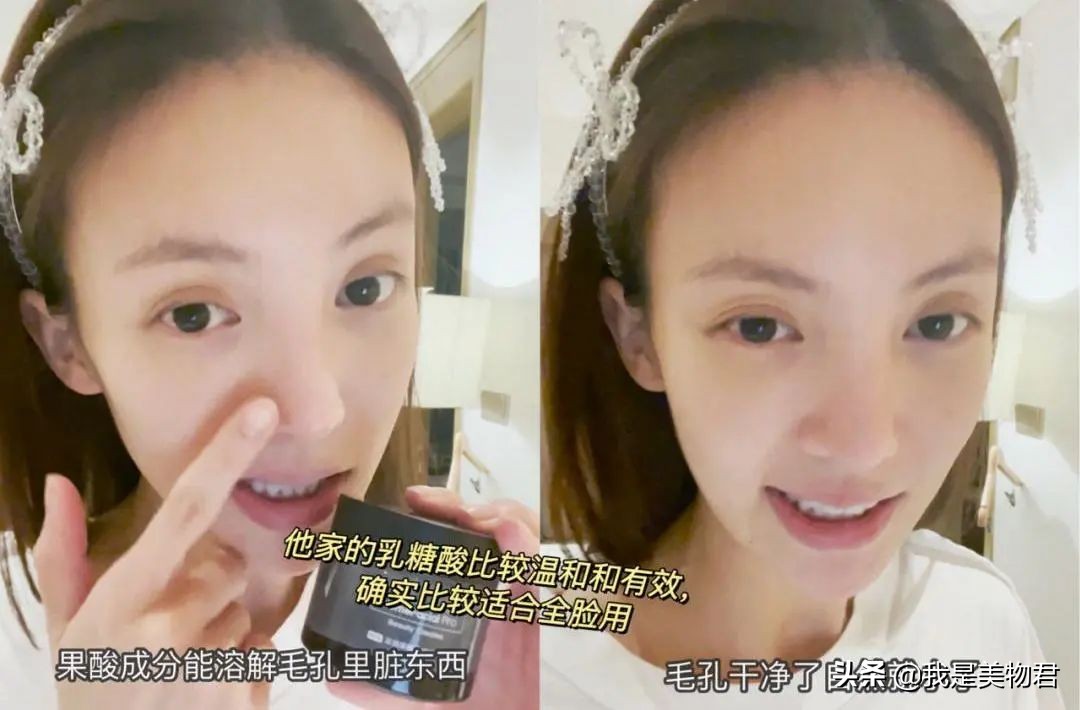 改善毛孔堵塞闭口粉刺,毛孔清道夫去闭口粉刺