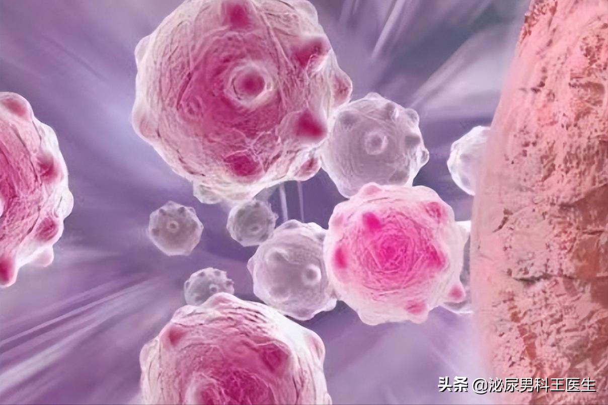 前列腺癌发现就是晚期？叶定伟教授：50岁以上最好每年检查一次