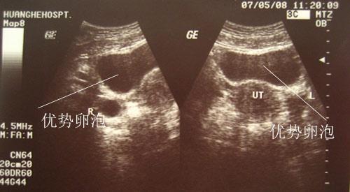 受孕最准确的特征,进入排卵期怎么判断已经排卵