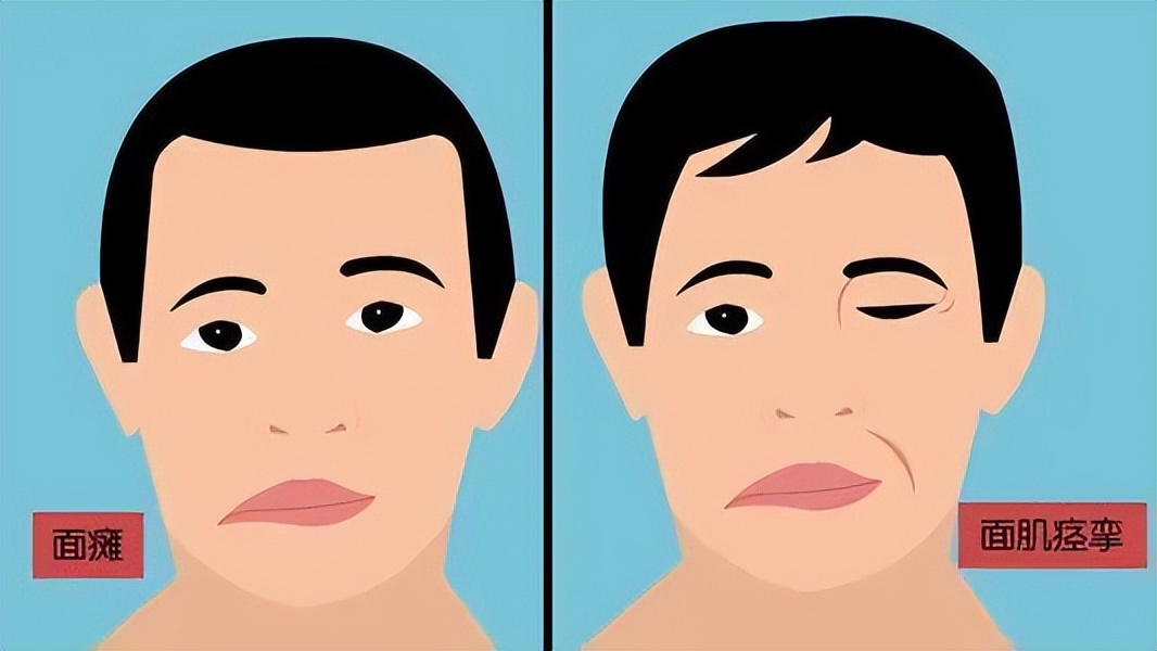 怪不得眼皮一直跳原来是这么回事,为什么眼皮跳真的有事发生了