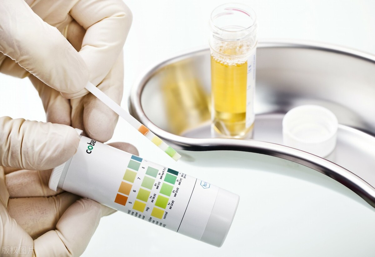 糖尿病干细胞移植能治好费用多少,一型糖尿病干细胞移植可以治愈不