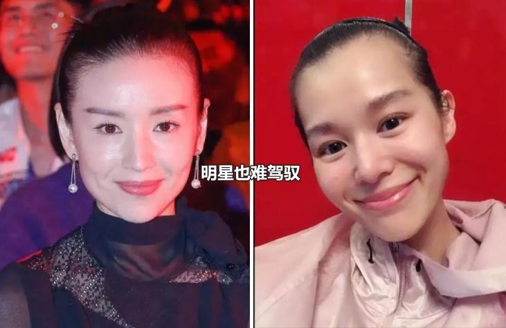 年纪大了为什么头发稀疏了,随着年龄增长头发变稀疏正常吗