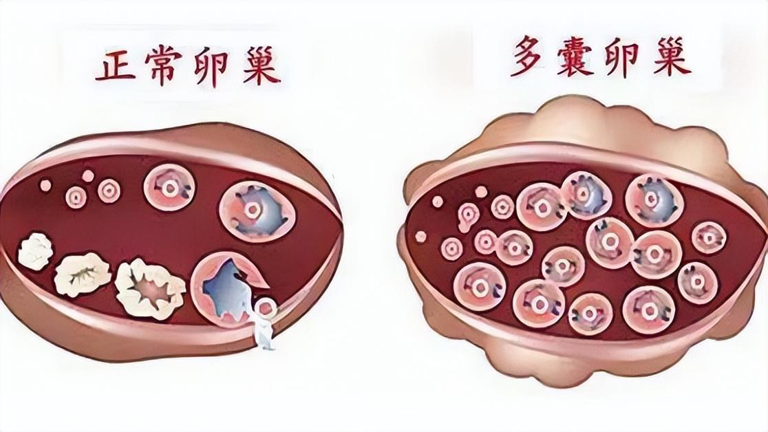 同房后酿成的悲剧：黄体破裂，夫妻生活不是打仗，要适度而行！