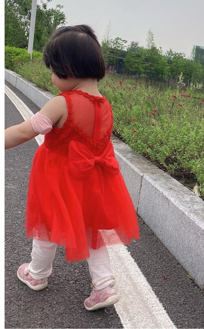 新技术与精准医学,血糖监测最新设备