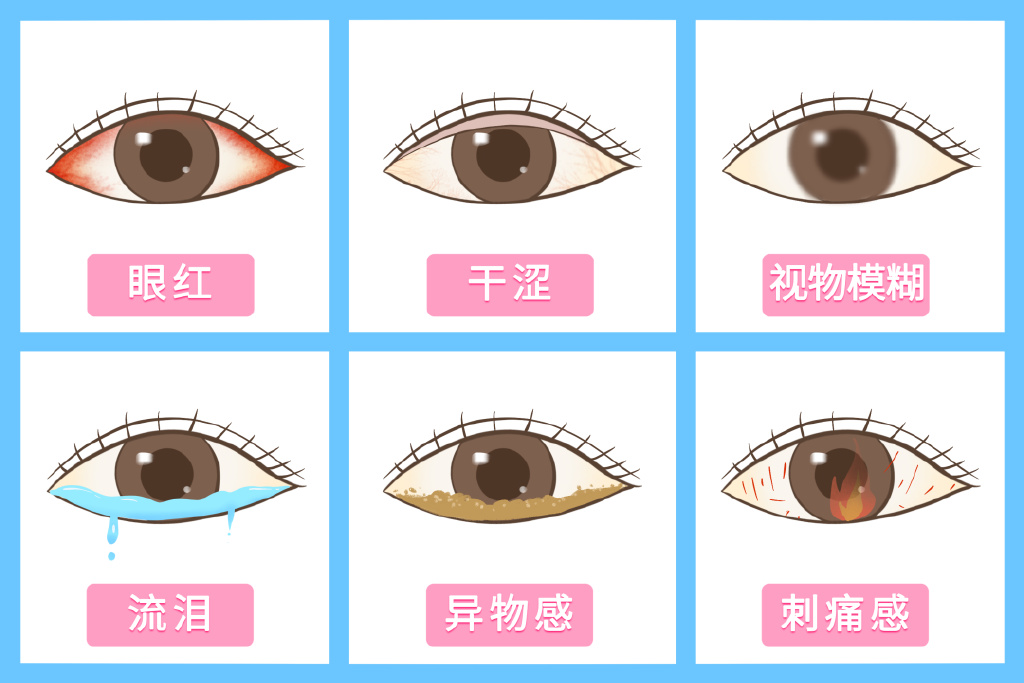 每天盯着电脑看怎么保护眼睛,长时间用电脑怎么保护眼睛近视