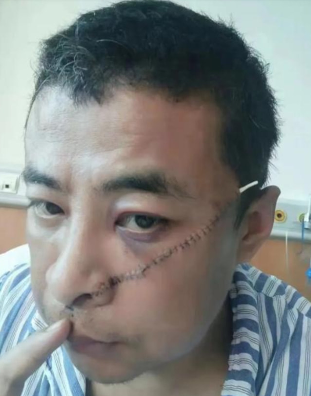 济南大肠哥挨打赔了多少钱,济南大肠哥被打事件谁打的