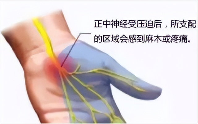 手指麻疼是颈椎引起的吗,右手手指麻手腕酸痛无力