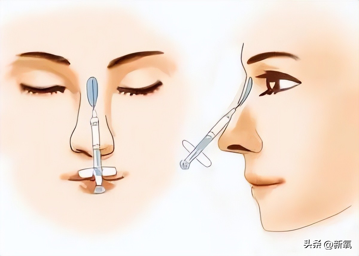 改一点赢很大？她整完鼻子直接美成断代神颜…