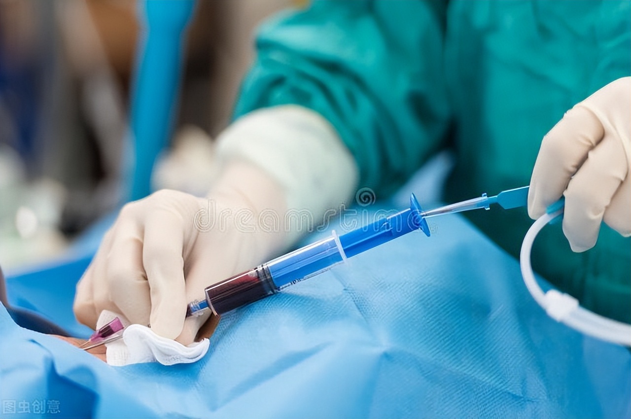 冠脉造影的危害和风险,冠脉造影有危险吗