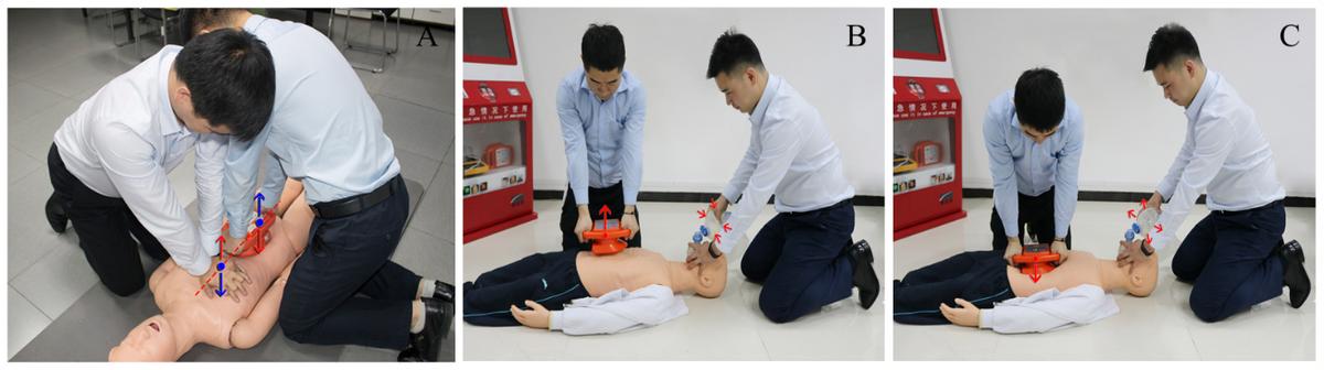 腹部提压心肺复苏术有用吗,腹部提压心肺复苏和胸外心脏按压