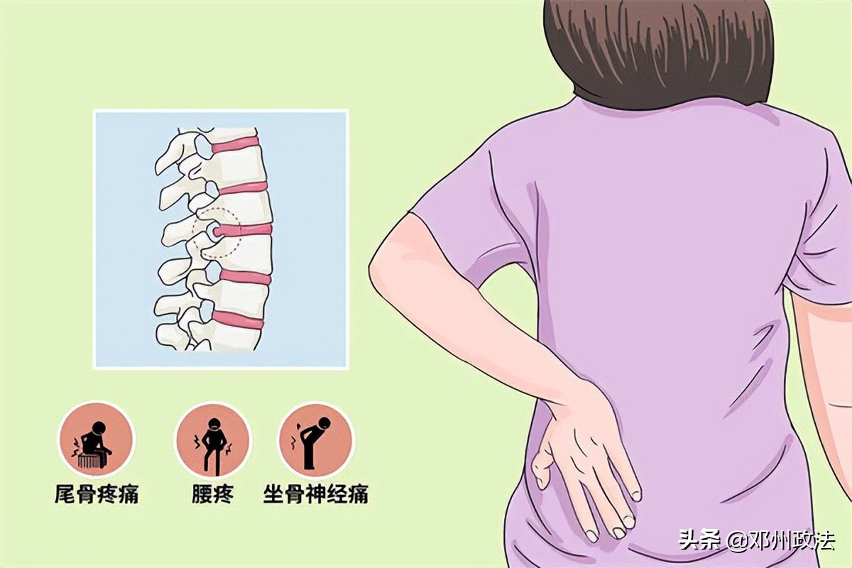 腰突压迫坐骨神经痛怎么治疗最好,腰突压迫神经臀部疼最好治疗方法
