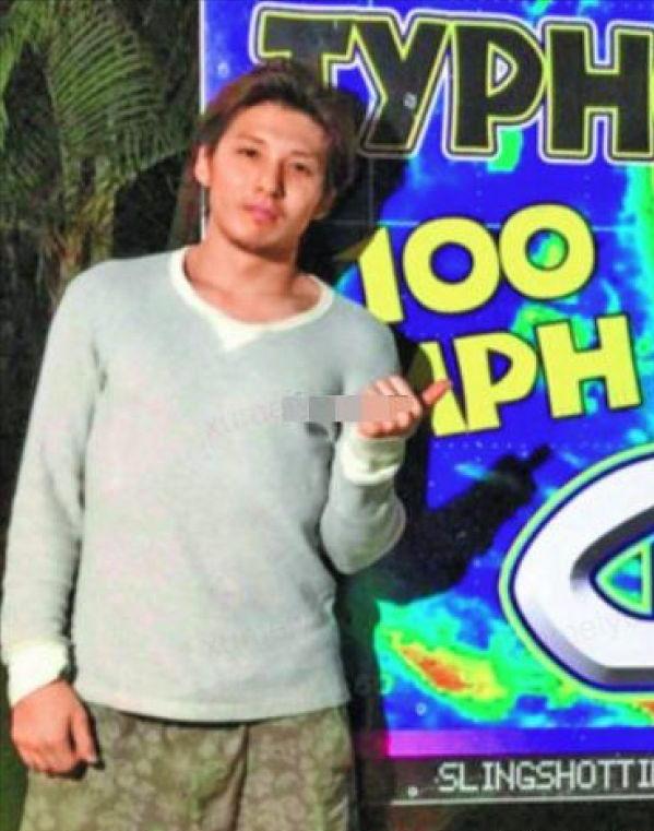 鐭冲師閲岀編绮夎壊琛ｆ湇寰瑧,鐭冲師閲岀編娌绘剤寮忕殑寰瑧