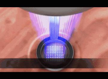 嫩肤窍门,嫩肤的小方法和步骤有哪些