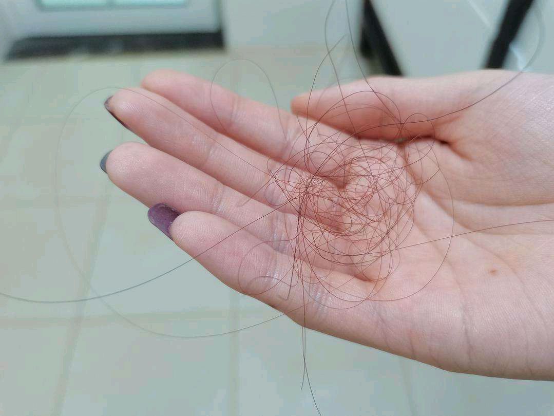 长时间用生姜洗头发会怎么样,生姜洗头发多久见效