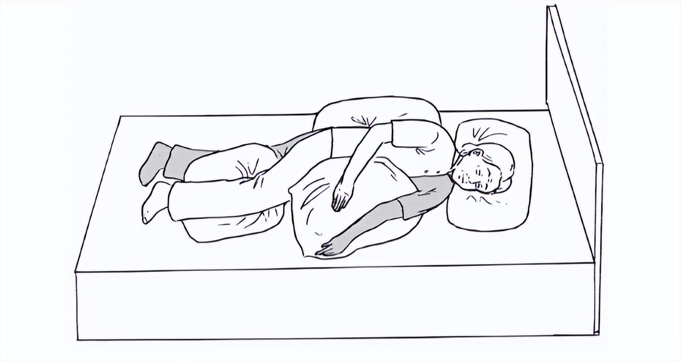 卒中病人如何自救,卒中患者需要做哪些检查