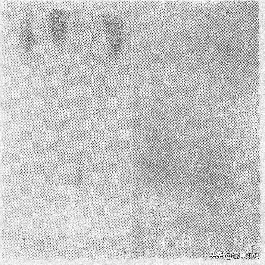 庆丰链霉菌是什么？关于它SQP1质粒的种间转移和表达