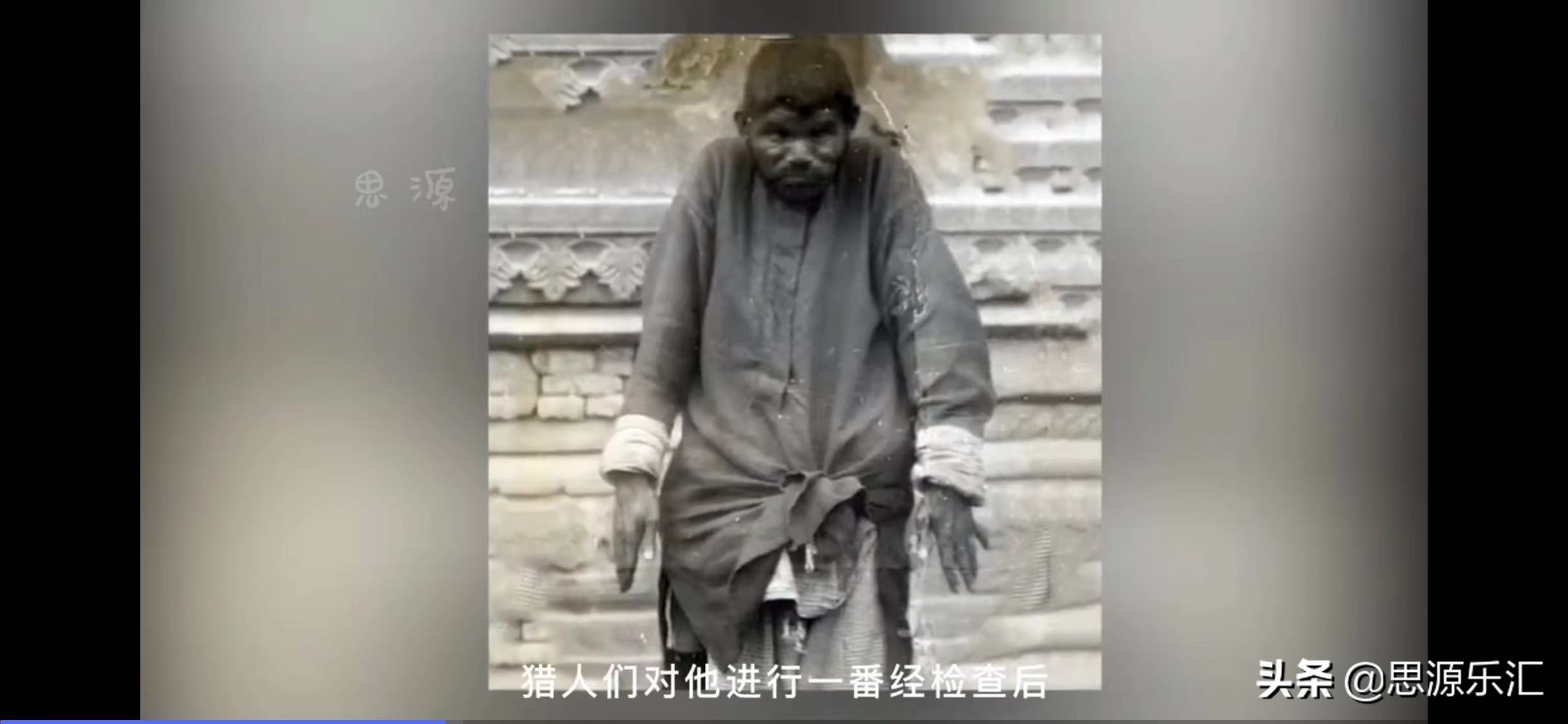 史上5大兽孩！狼孩、狗孩、小羚羊回归文明社会后，怎么样了呢？