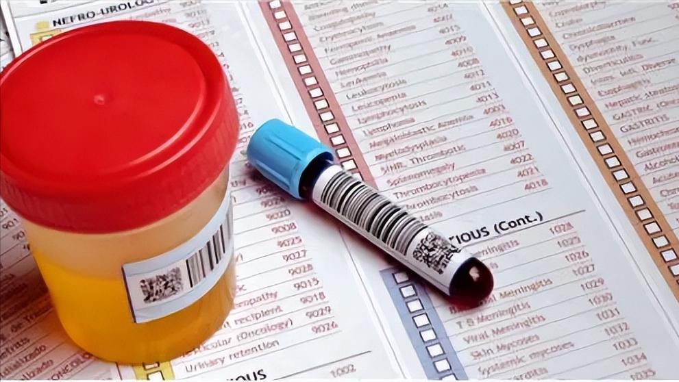 肾脏验血和彩超没问题尿有泡沫,尿里有泡沫是豆类惹的祸吗