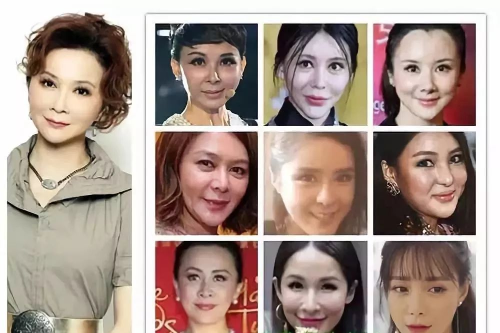 千娇百媚风情万种明星,有美人痣的6位女星