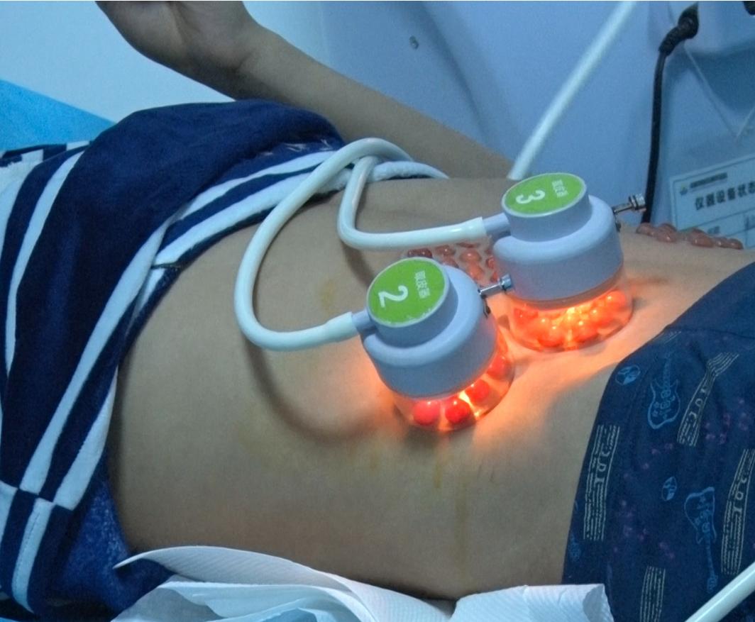 他克莫司对治疗白癜风有效吗,他克莫司治白癜风有效吗