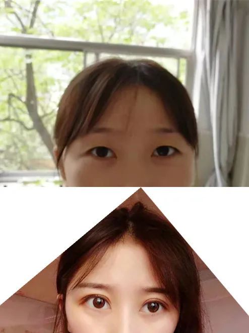 美丽双眸，轻松拥有，让心灵之窗绽放光彩！这些优惠也别错过哦