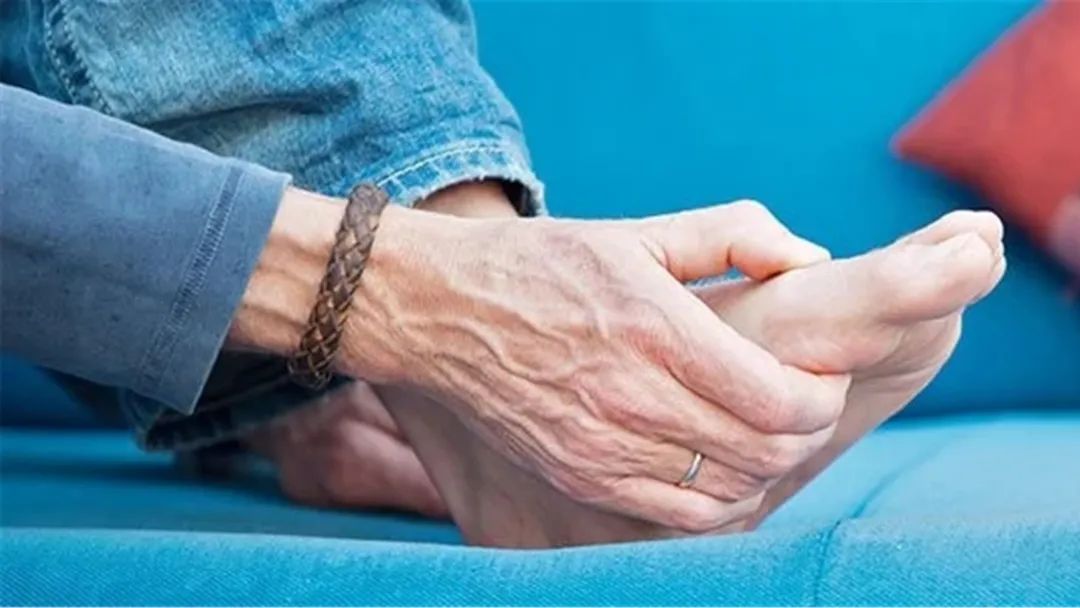 糖尿病神经末梢炎怎么缓解疼痛,糖尿病性神经痛